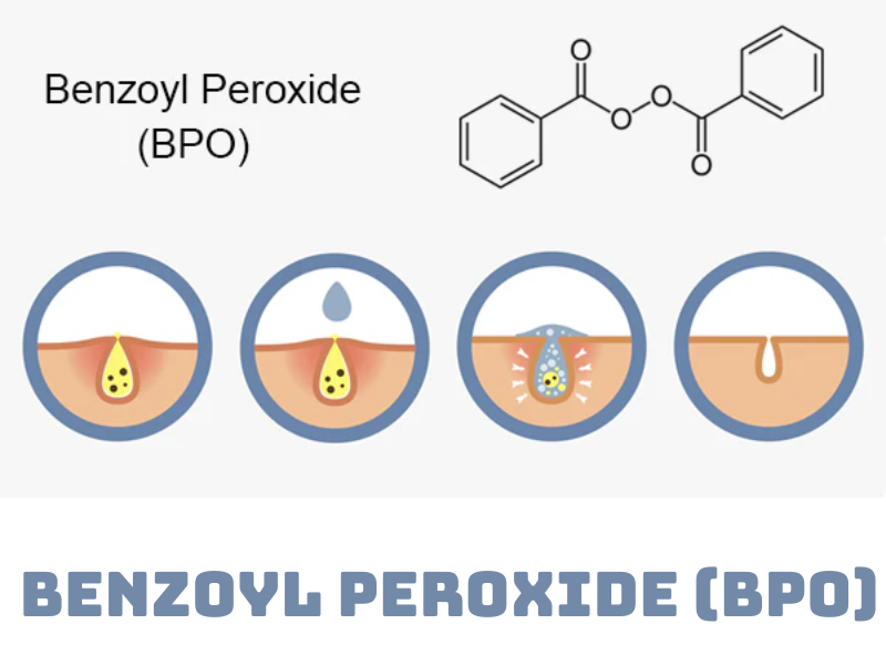Benzoyl Peroxide kết hợp với gì (1)