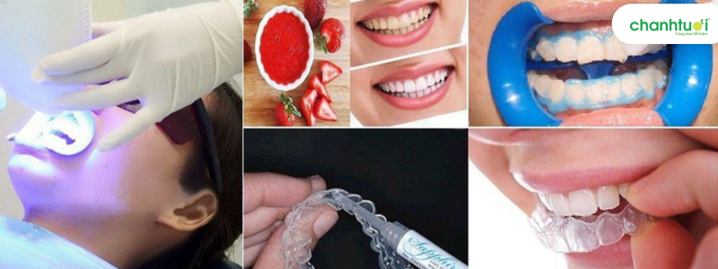các phương pháp tẩy trắng răng hiện nay