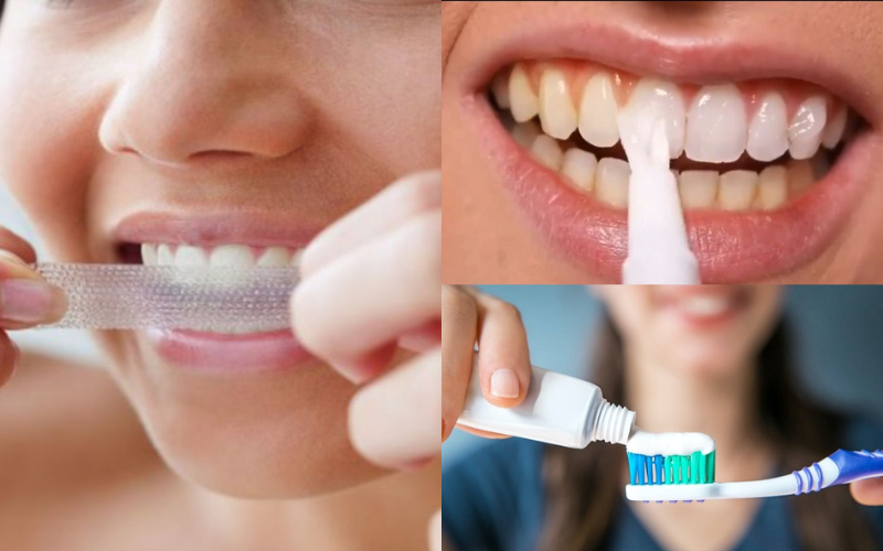 các phương pháp tẩy trắng răng otc