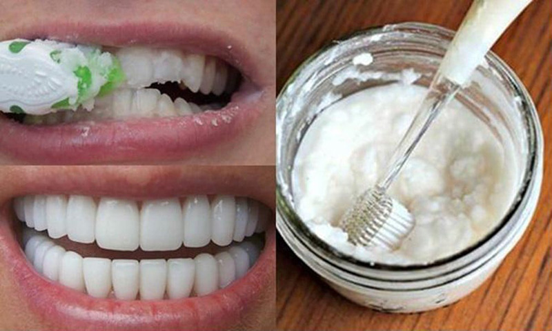 các phương pháp tẩy trắng răng tự nhiên 1