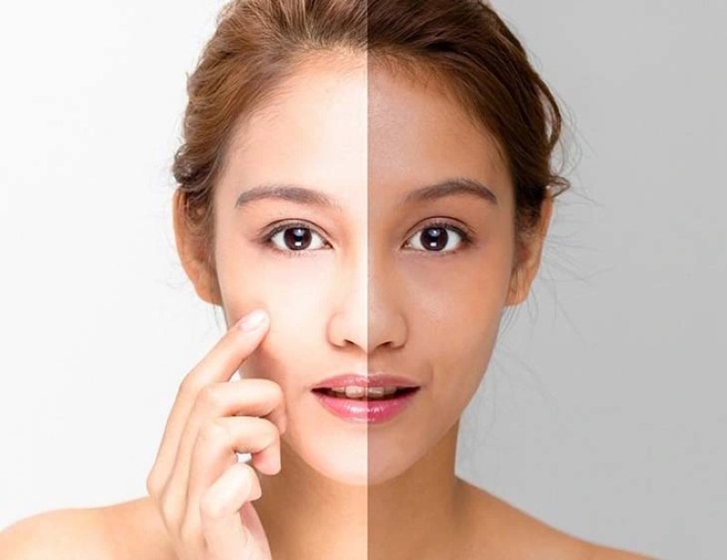 Có nên dùng kem dưỡng trắng da không 1