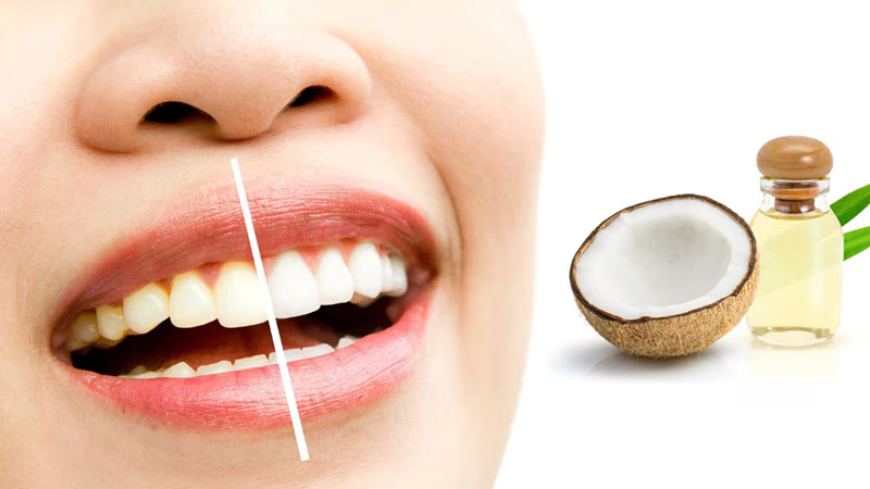 coconut-oil-whitens-teeth