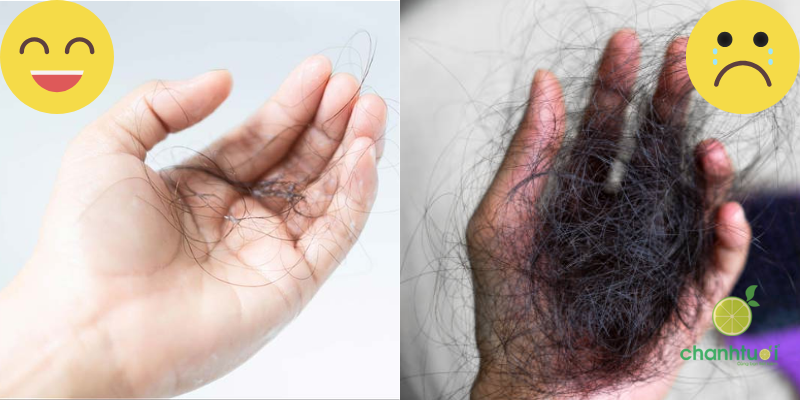 Gội đầu rụng bao nhiêu tóc là bình thường 2