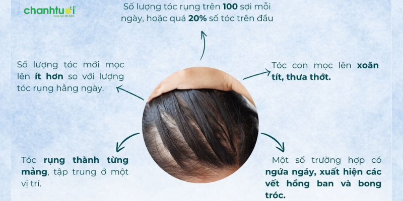 Gội đầu rụng bao nhiêu tóc là bình thường 3