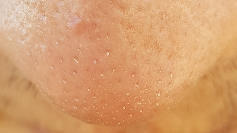 sợi bã nhờn là gì 1