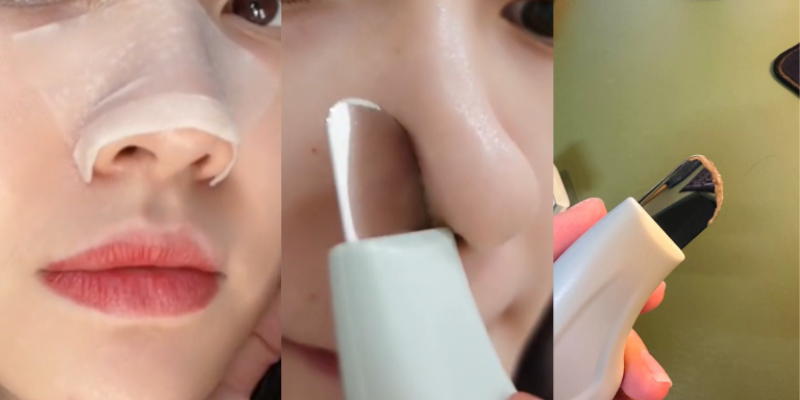 sợi bã nhờn là gì 6
