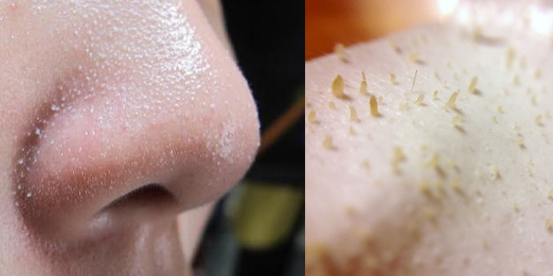 sợi bã nhờn là gì 2
