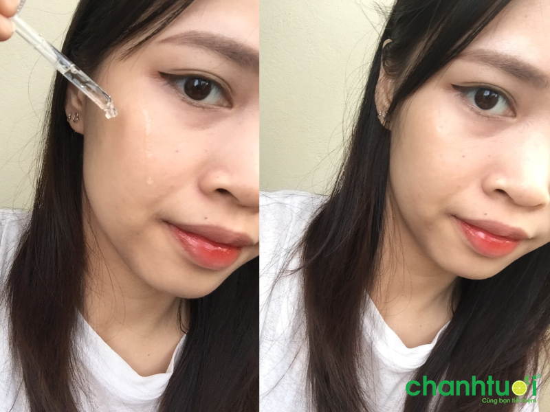 trải nghiệm Madagascar Centella Ampoule