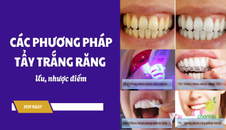 cac-phuong-phap-tay-trang-rang-thumb