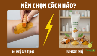 cach-boi-nghe-tuoi-tri-seo-add