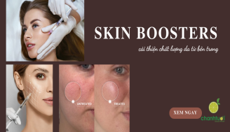 skin-boosters-add