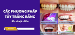 cac-phuong-phap-tay-trang-rang-thumb