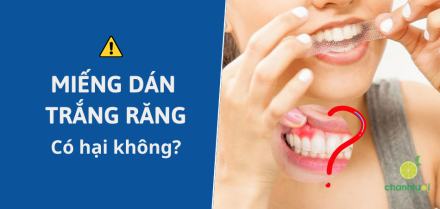 Tranh cãi miếng dán trắng răng có hại: Khoa học nói gì?