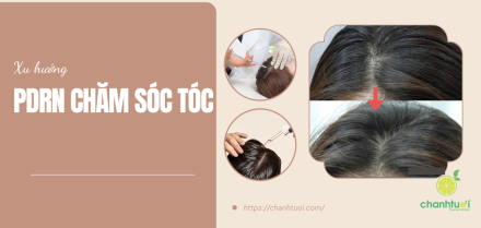Xu hướng PDRN chăm sóc tóc: Phục hồi tóc yếu, thưa mỏng