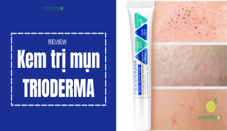 review-kem-tri-mun-trioderma-add