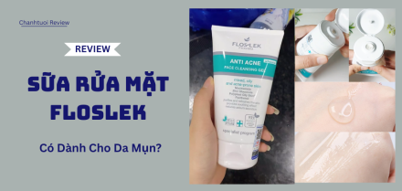Da dầu mụn có nên dùng sữa rửa mặt Floslek? Trải nghiệm thực tế sau 7 ngày!