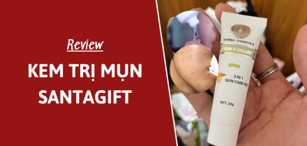 Review kem trị mụn Santagift có hiệu quả không? Có hơn Megaduo?