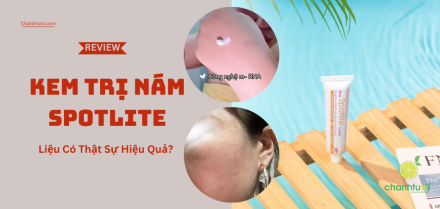 Review kem trị nám Spotlite - Đắt nhưng có đáng tiền không?
