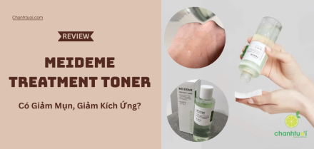 MEIDEME Toner có thật sự làm dịu da mụn? Mình đã thử và đây là kết quả!