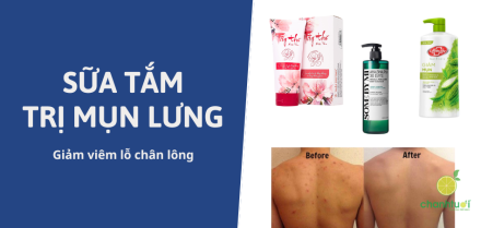 Sữa tắm trị mụn lưng, giảm viêm nang lông tốt nhất