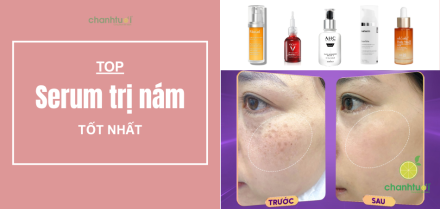 Serum trị nám tốt nhất