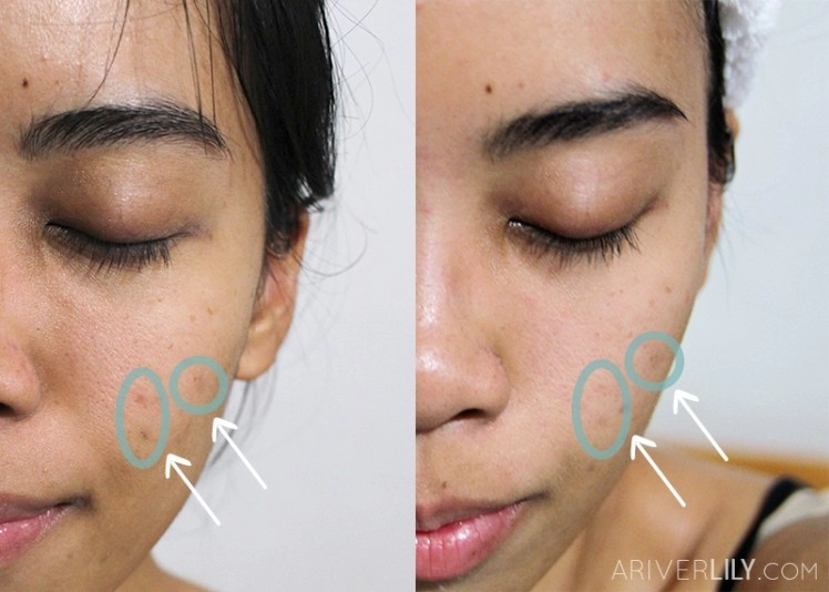 huyết thanh chống lão hóa