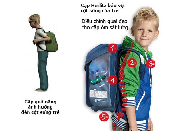 cặp chống gù