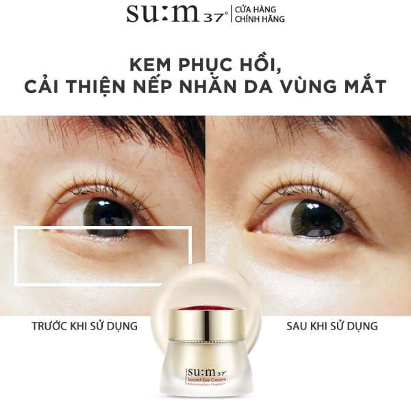 mỹ phẩm Su:m37