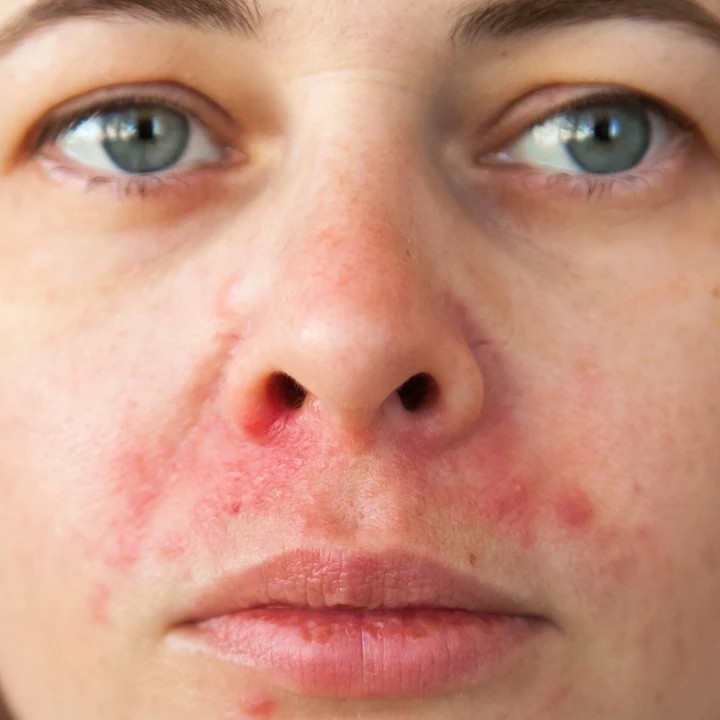 cach-chon-serum-cho-da-nhay-cam
