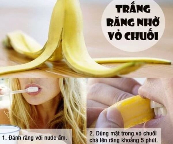 cách làm trắng răng