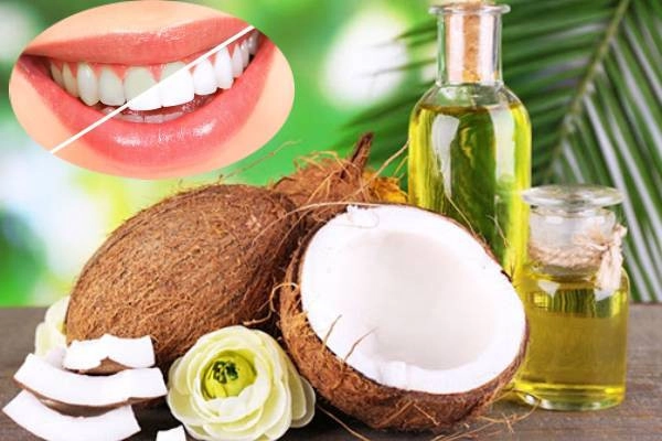 cách làm trắng răng