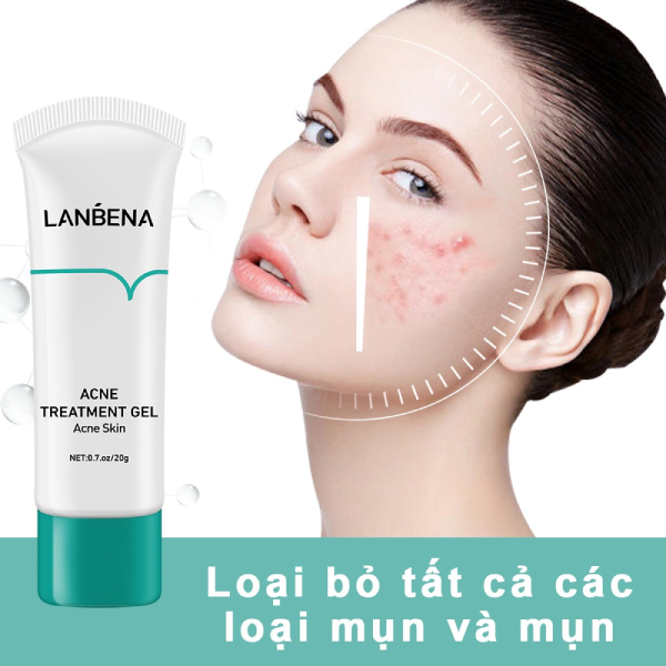 kem trị mụn cho nam
