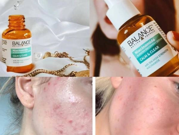 Serum Balance