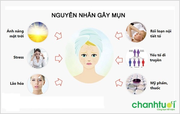 cách điều trị mụn viêm sưng