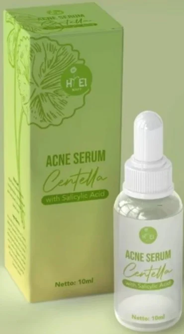 Tinh chất trị mụn Hi El Beauty Acne Serum