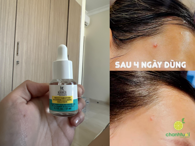chấm mụn kiehl's (2)