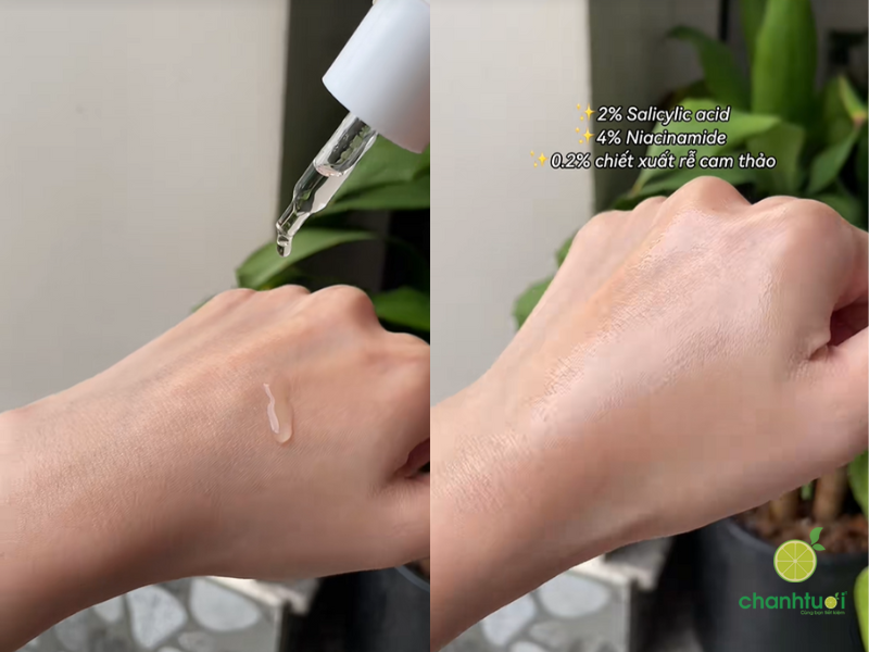 chấm mụn kiehl's (4)