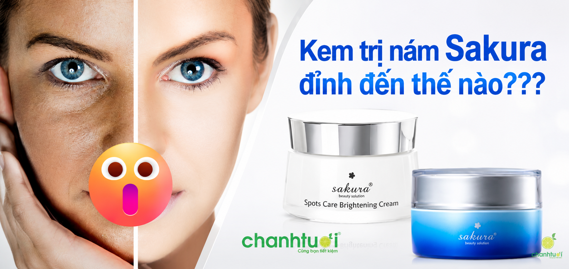 Review 4 Kem Dưỡng Sakura: Loại Nào Trị Nám Tàn Nhang Tốt Đáng Dùng