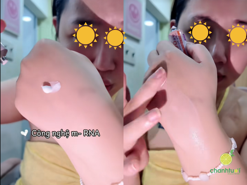 kem trị nám spotlite (2)