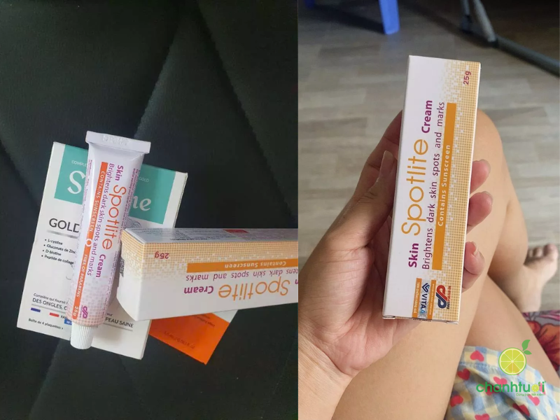 kem trị nám spotlite (4)
