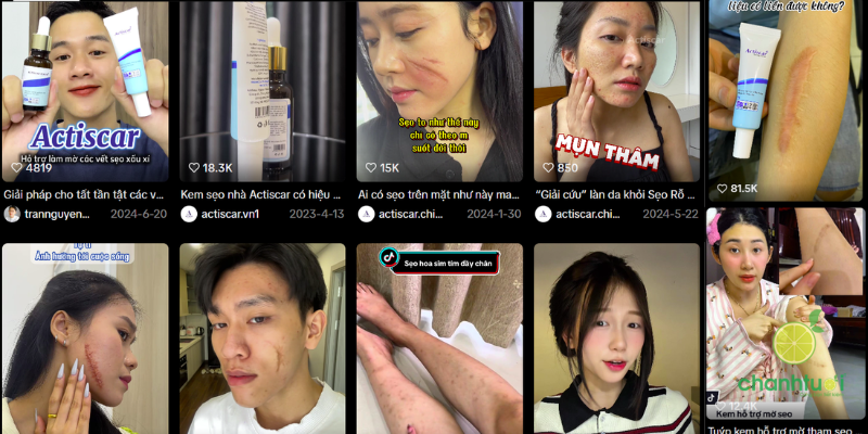 kem-tri-seo-actiscar-0