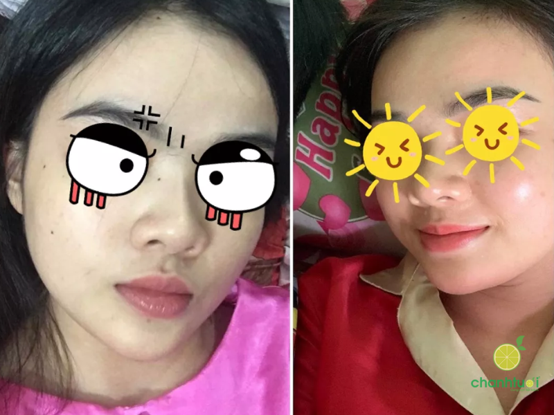 Niacinamide Zakka (5)