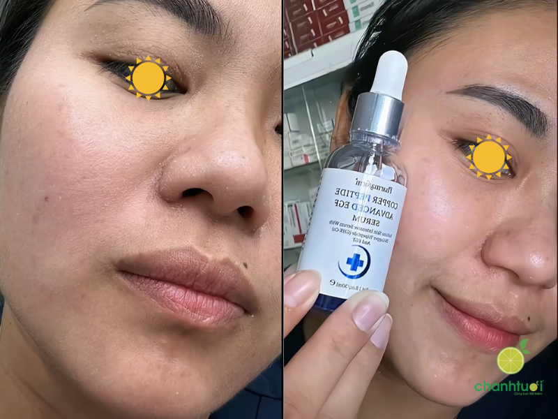 Pharmaform Copper Peptide Advanced EGF (1)