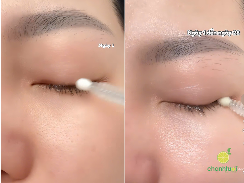 Serum dưỡng mi Công Ken Advanced Eyelash (2)