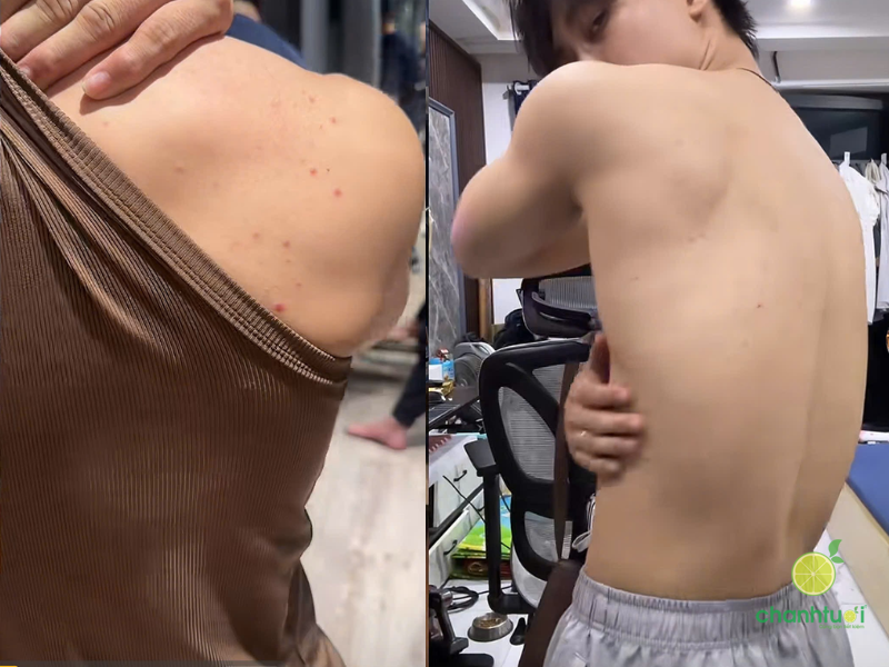 Xà phòng rửa mặt Acne-Aid (3)