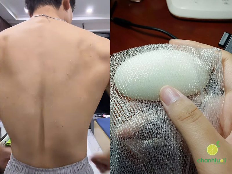 Xà phòng rửa mặt Acne-Aid (4)