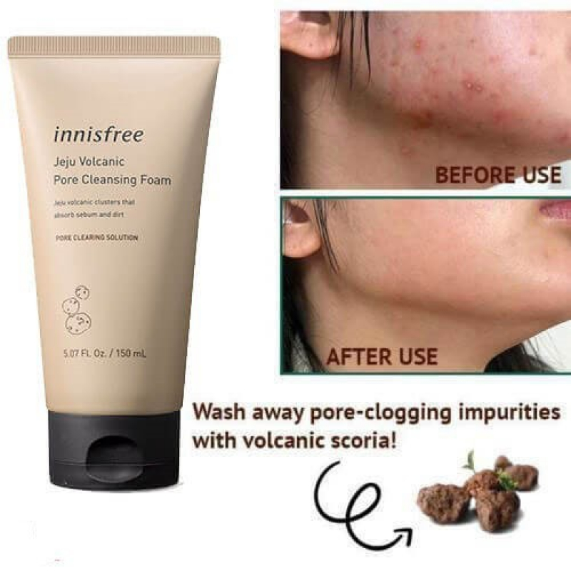 Sữa rửa mặt innisfree trắng da làm sạch Tro Túi Lửa Innisfree Hàn Quốc